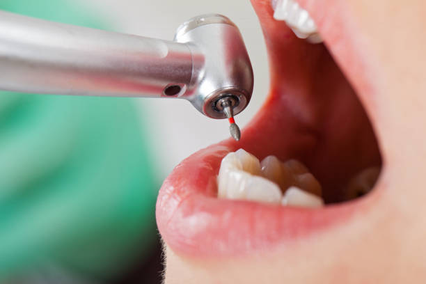 Best Emergency Treatment for Toothache in Brownville, NJ